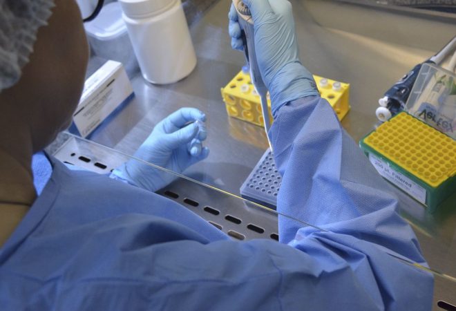 O Laboratório Central de Saúde Pública de Santa Catarina (LACEN) está realizando exames para identificação do novo coronavírus (COVID-19)