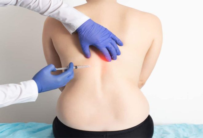 Ozonioterapia