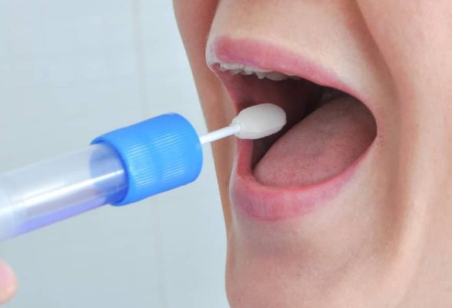 analise-de-saliva