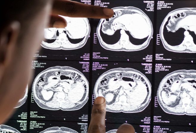Doctor reading brain MRI x-ray result