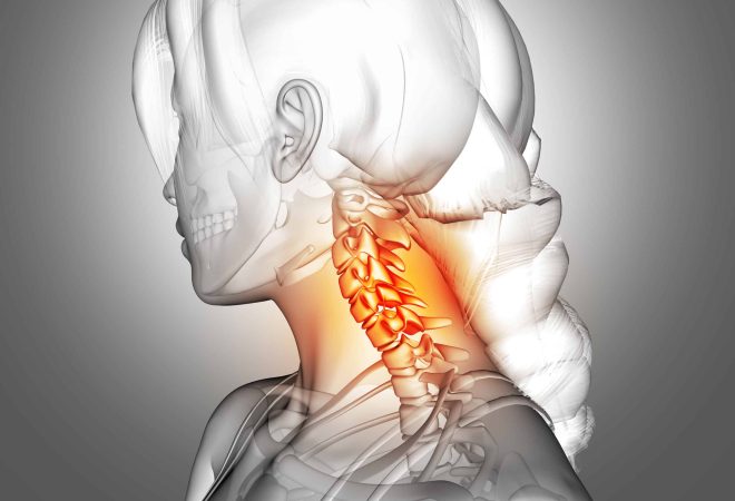 3D render of a female figure with neck bones highlighted