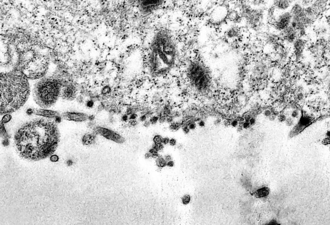 Várias partículas virais de Sars-CoV-2 (pontos escuros) aderidas à membrana da célula. Registro do momento exato em que uma célula é infectada pelo novo coronavírus, obtido durante estudo que investiga a replicação viral do Sars-CoV-2 realizado pelos Laboratório de Morfologia e Morfogênese Viral e Laboratório de Vírus Respiratórios e do Sarampo, Instituto Oswaldo Cruz.