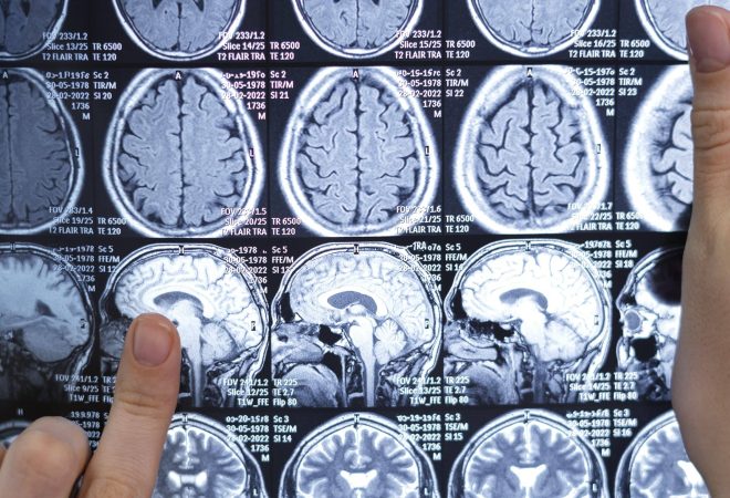 medico-olhando-por-tomografia-computadorizada