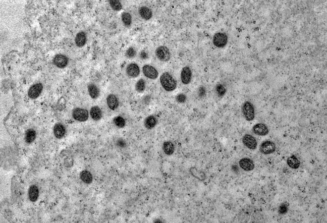 A varíola dos macacos é transmitida pelo vírus monkeypox, que pertence ao gênero orthopoxvirus