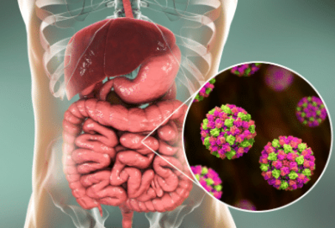 norovirus