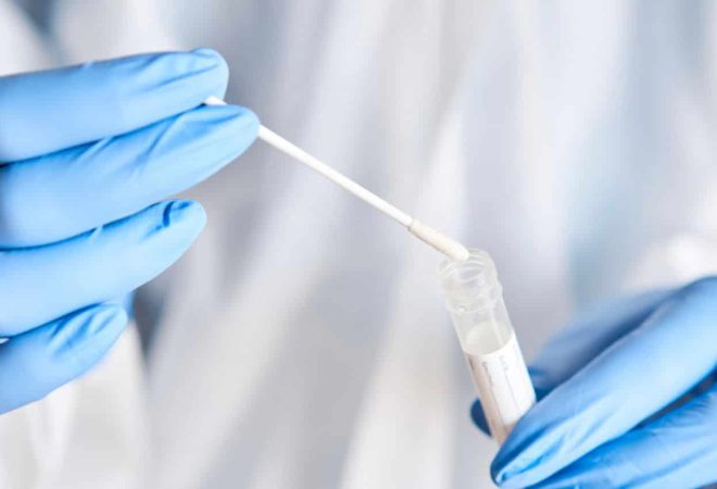 rnk-teste-covid-antigeno-swab