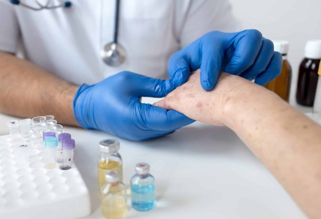 skin-allergy-on-a-person-s-arm