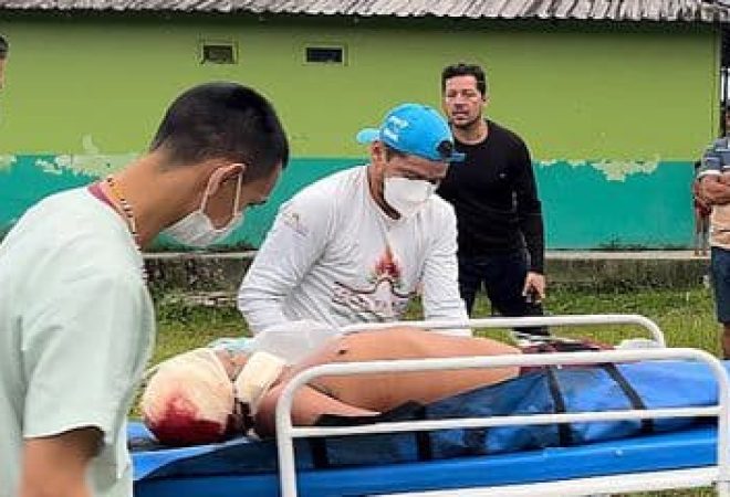 Atentado a Yanomamis - Na tarde deste sábado (29/04) garimpeiros armados alvejaram três (03) jovens Yanomami, sendo um (01) deles, agente indígena de saúde da Comunidade Uxiú. Foto: Hekurari/INSTAGRAM