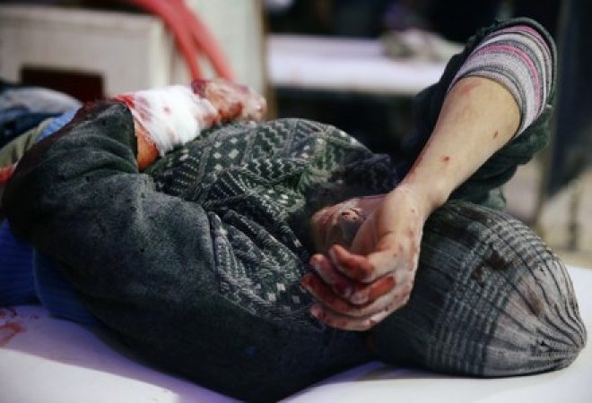 Homem ferido é visto em centro médico na cidade de Douma, na região síria de Ghouta Oriental