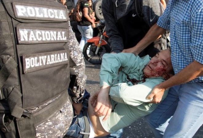 Teodoro Campos, chefe de segurança do candidato de oposição à Presidência da Venezuela, Henri Falcón, recebe ajuda após sofrer lesão em Caracas