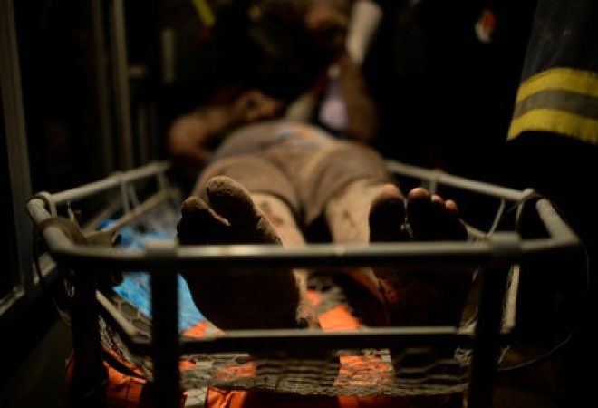 Homem coberto de cinzas e queimaduras é levado a hospital após erupção de vulcão em El Rodeo, na Guatemala