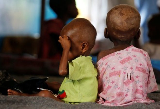 Crianças desnutridas em hospital da República Democrática do Congo